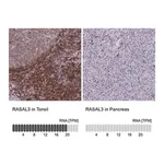 Merck Anti-RASAL3 antibody produced in rabbit