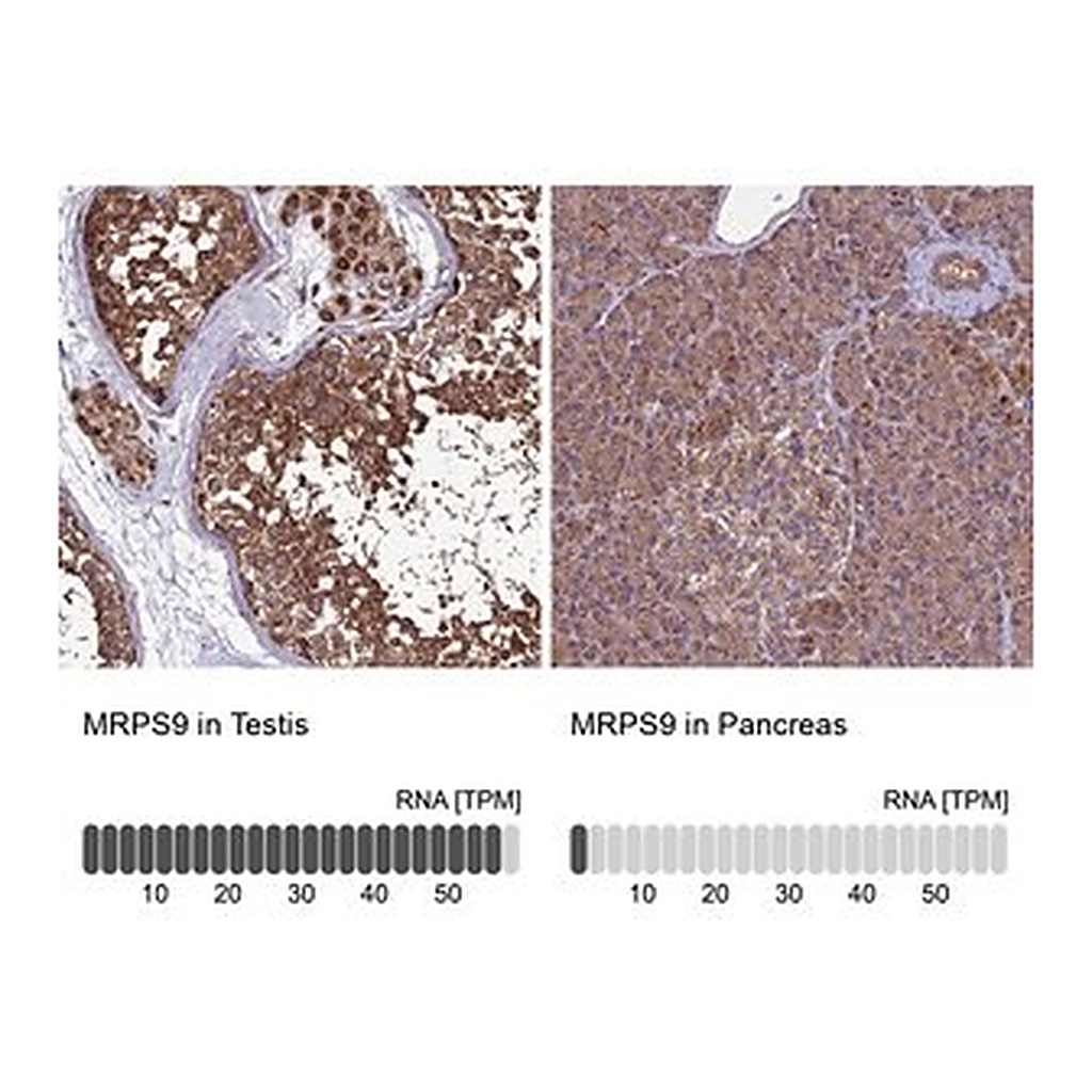 Merck Anti-MRPS9 antibody produced in rabbit