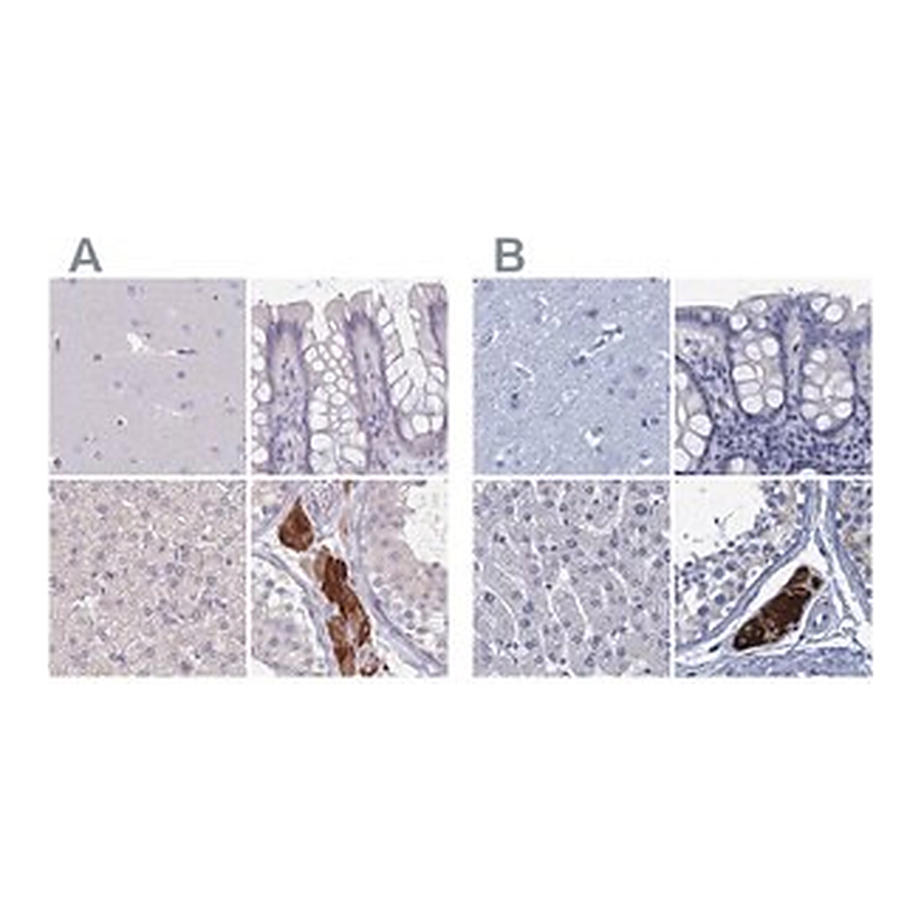 Merck Anti-CYP51A1 antibody produced in rabbit