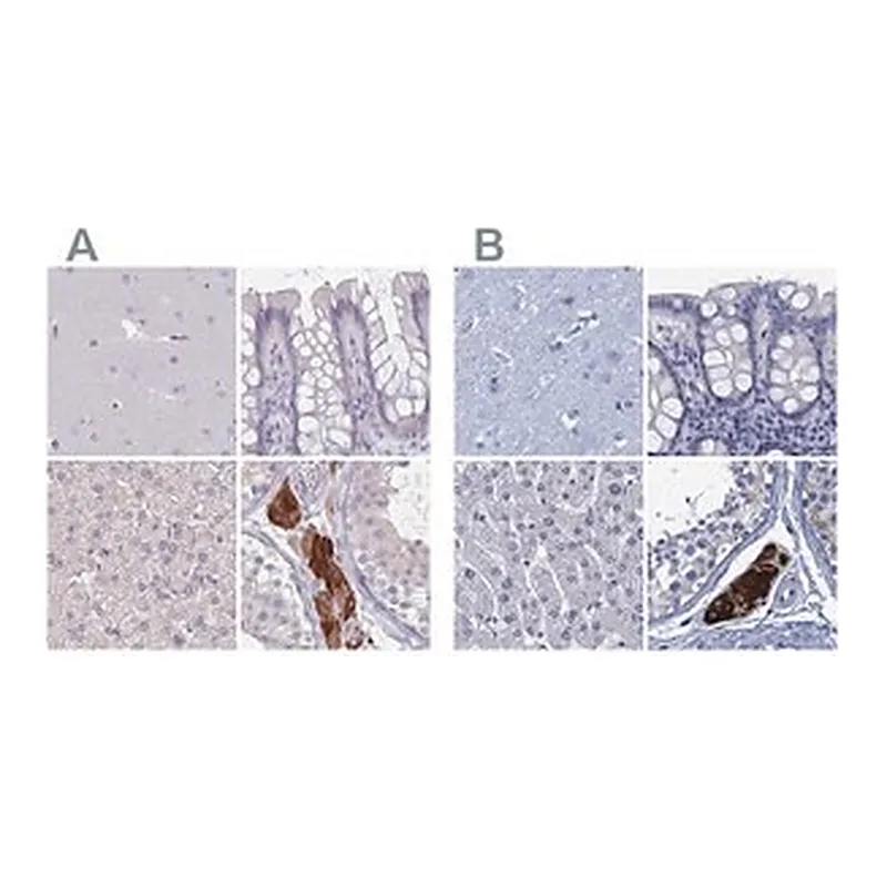 Merck Anti-CYP51A1 antibody produced in rabbit