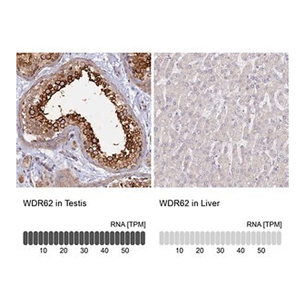 Merck Anti-WDR62 antibody produced in rabbit