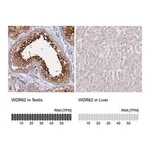Merck Anti-WDR62 antibody produced in rabbit