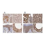 Merck Anti-PSMD9 antibody produced in rabbit