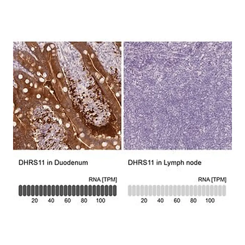 Merck Anti-DHRS11 antibody produced in rabbit