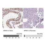 Merck Anti-KPNA1 antibody produced in rabbit