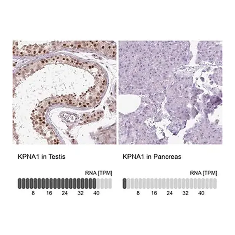 Merck Anti-KPNA1 antibody produced in rabbit