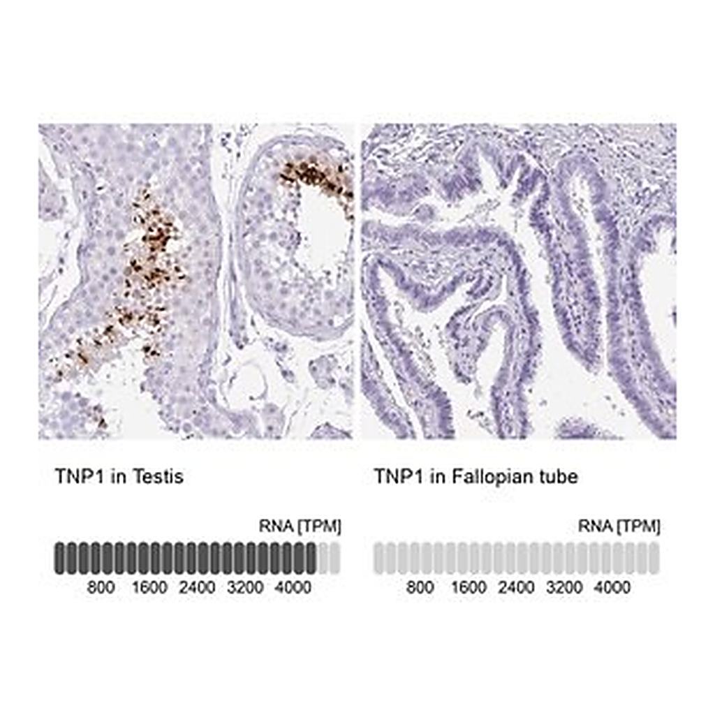 Merck Anti-TNP1 antibody produced in rabbit