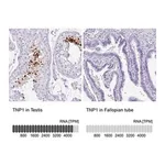 Merck Anti-TNP1 antibody produced in rabbit