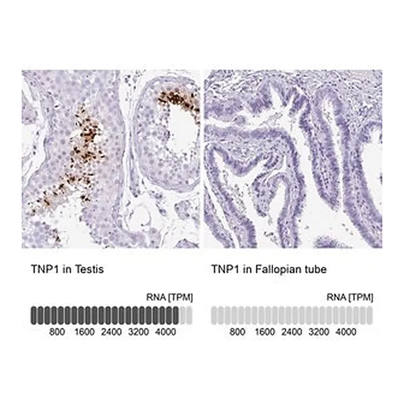 Merck Anti-TNP1 antibody produced in rabbit