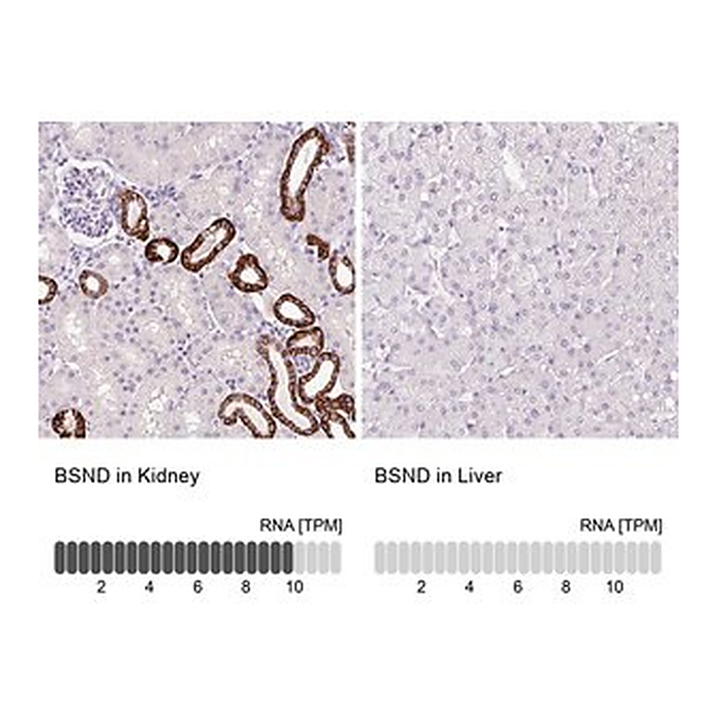 Merck Anti-BSND antibody produced in rabbit