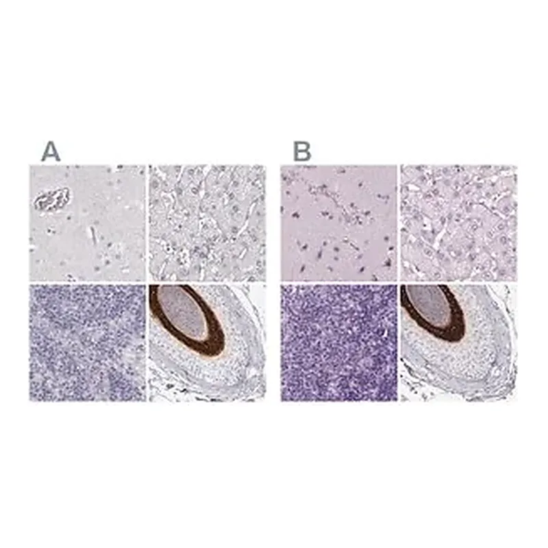 Merck Anti-KRT25 antibody produced in rabbit