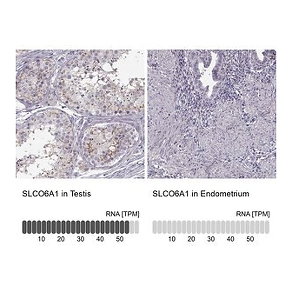 Merck Anti-SLCO6A1 antibody produced in rabbit