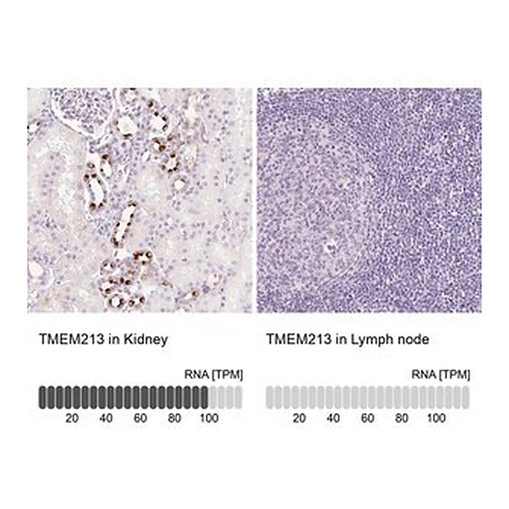 Merck Anti-TMEM213 antibody produced in rabbit