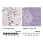 Merck Anti-TMEM213 antibody produced in rabbit