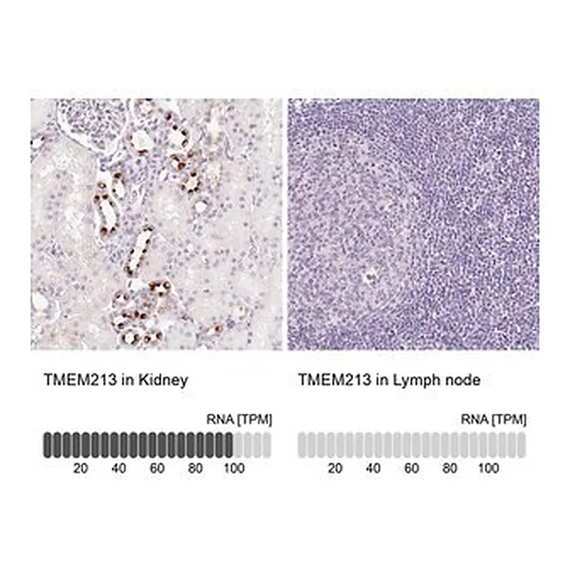 Merck Anti-TMEM213 antibody produced in rabbit