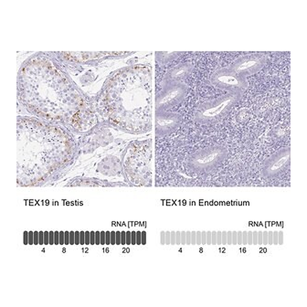 Merck Anti-TEX19 antibody produced in rabbit