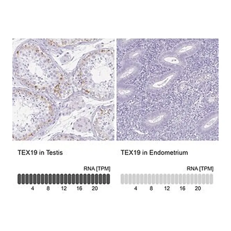 Merck Anti-TEX19 antibody produced in rabbit