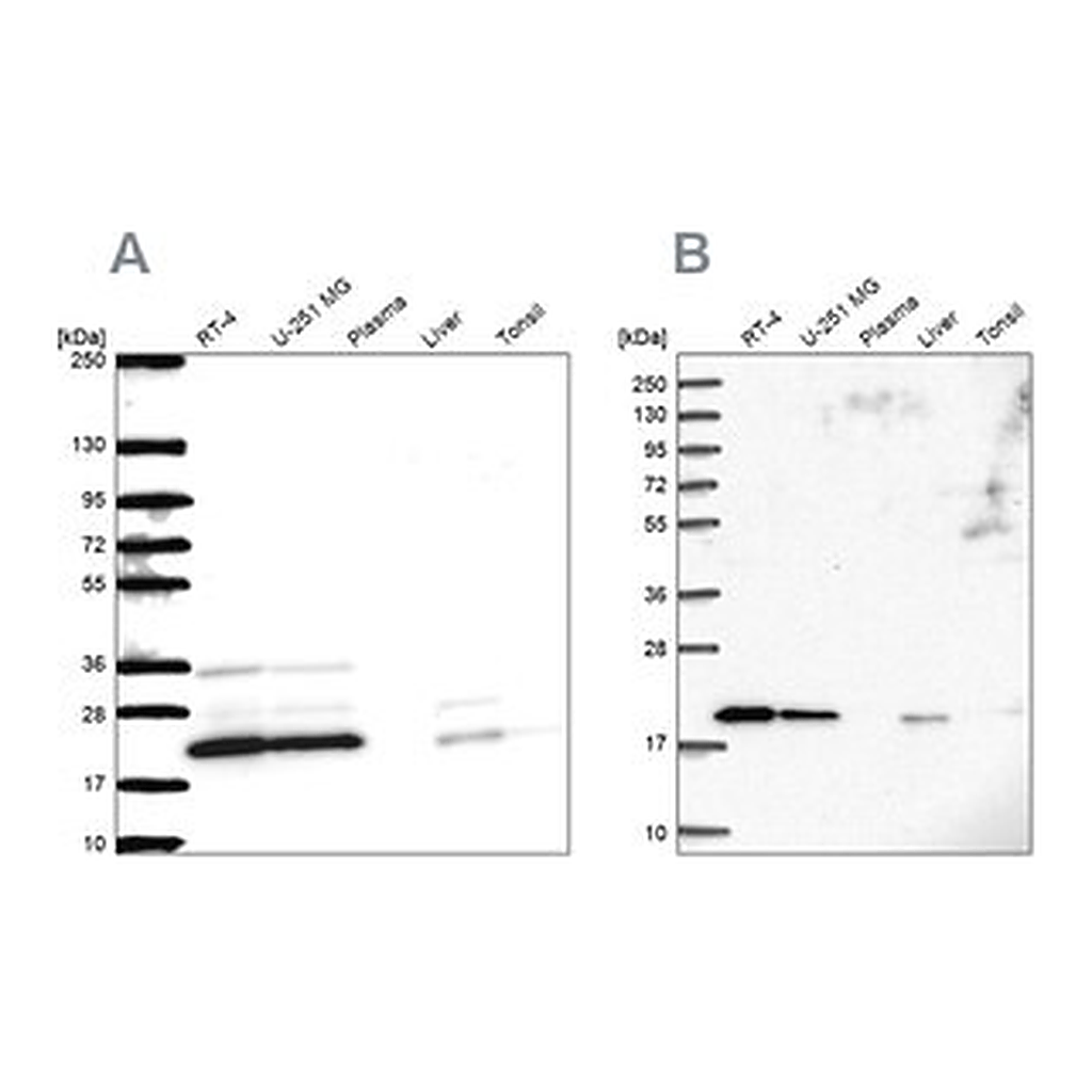 Merck Anti-NDUFAF2 antibody produced in rabbit