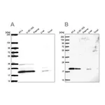 Merck Anti-NDUFAF2 antibody produced in rabbit