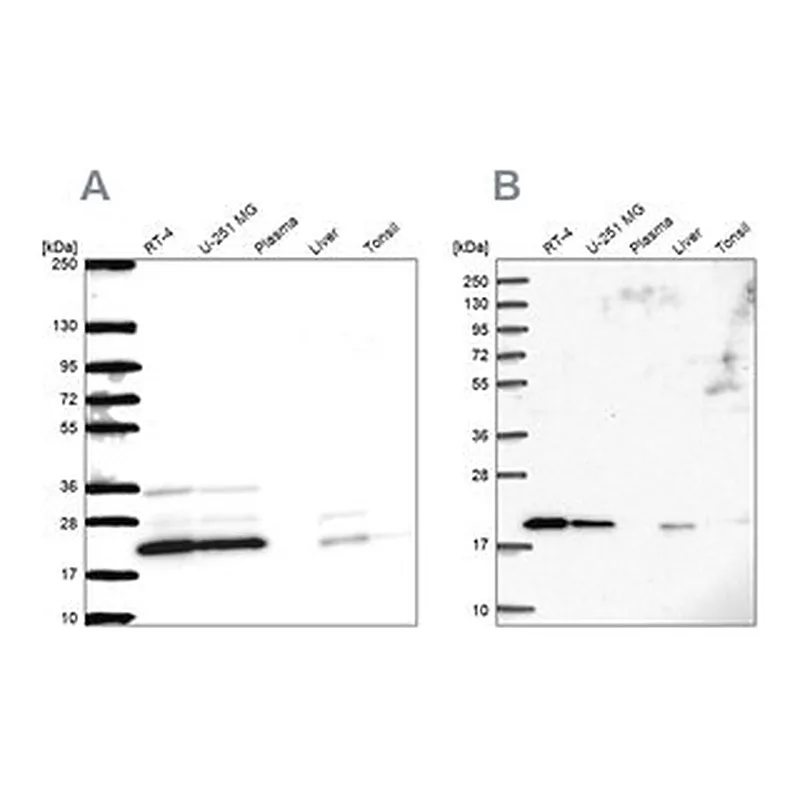 Merck Anti-NDUFAF2 antibody produced in rabbit