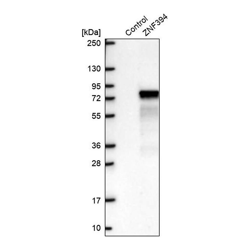 Merck Anti-ZNF394 antibody produced in rabbit