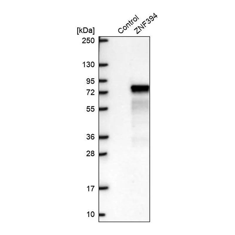 Merck Anti-ZNF394 antibody produced in rabbit