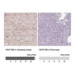 Merck Anti-WNT10B antibody produced in rabbit