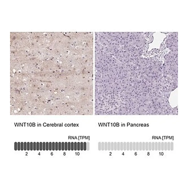 Merck Anti-WNT10B antibody produced in rabbit