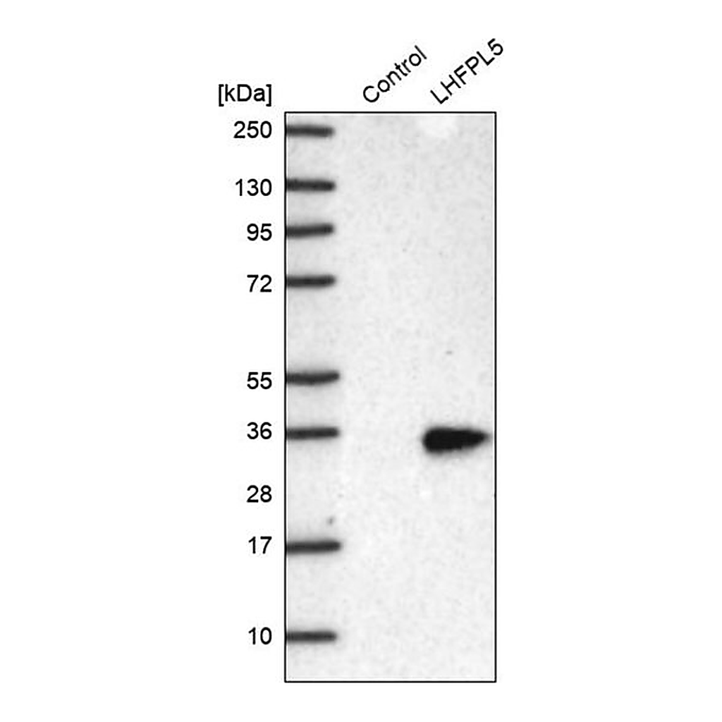 Merck Anti-LHFPL5 antibody produced in rabbit