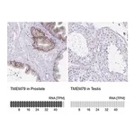 Merck Anti-TMEM79 antibody produced in rabbit