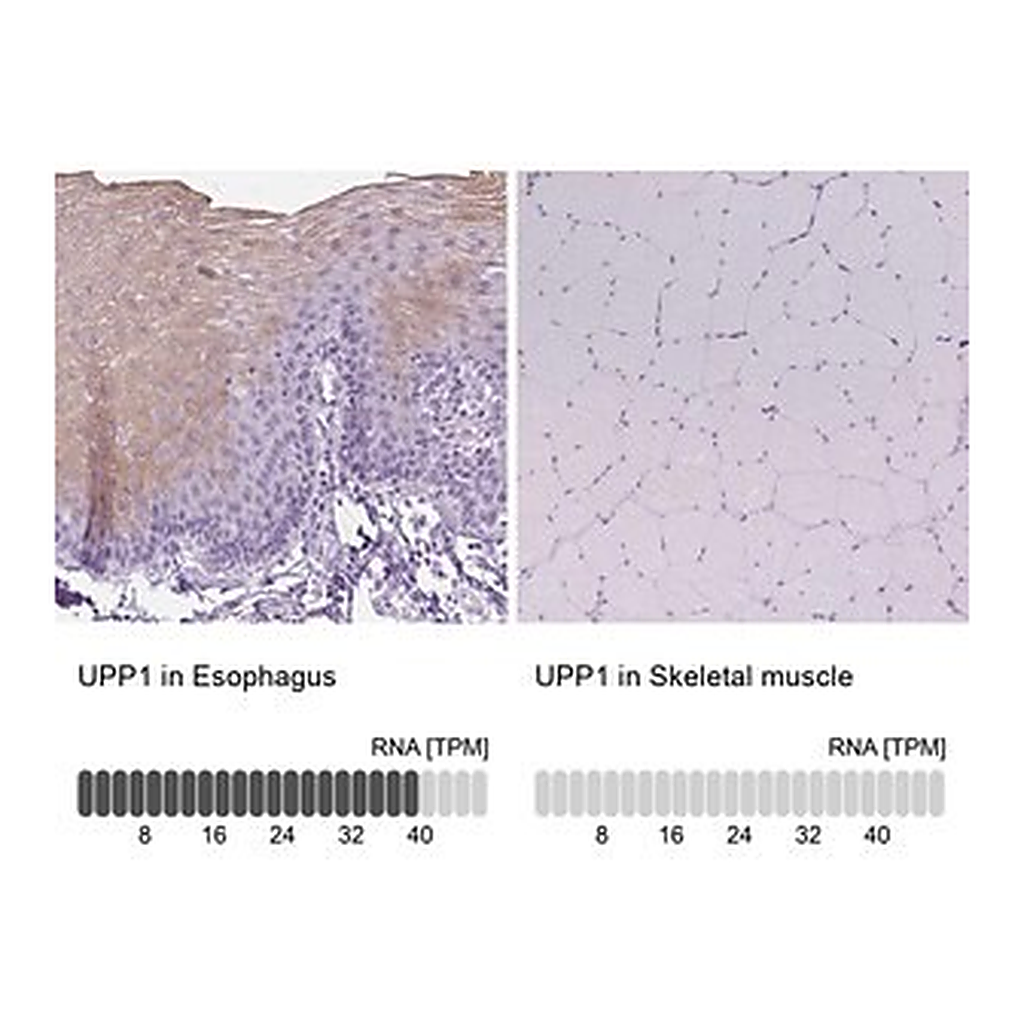 Merck Anti-UPP1 antibody produced in rabbit