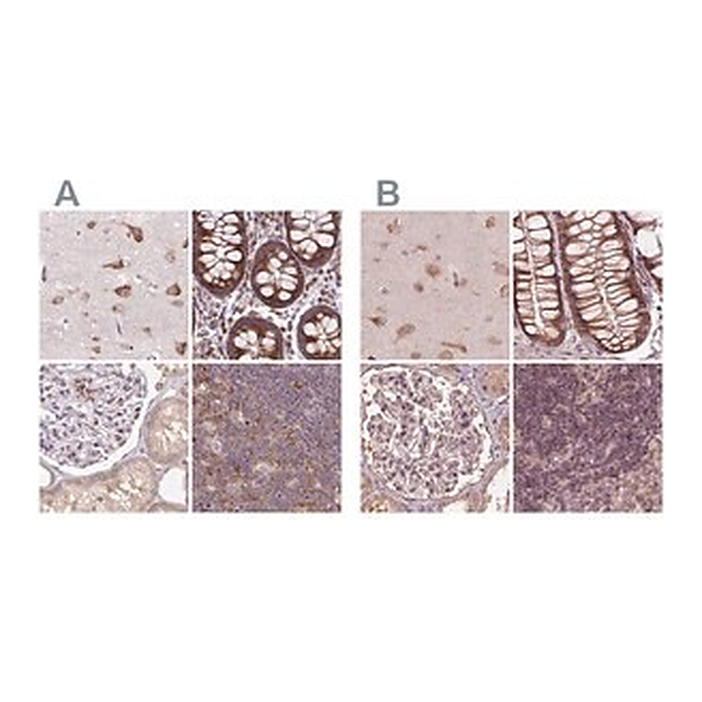 Merck Anti-RPS5 antibody produced in rabbit