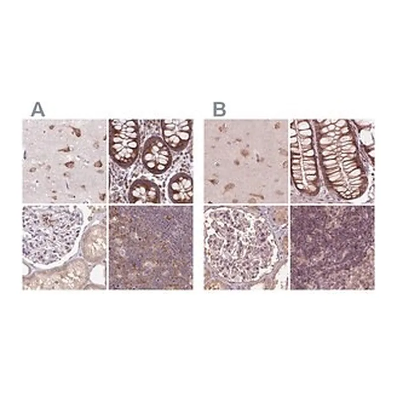 Merck Anti-RPS5 antibody produced in rabbit