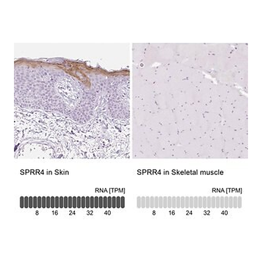 Merck Anti-SPRR4 antibody produced in rabbit