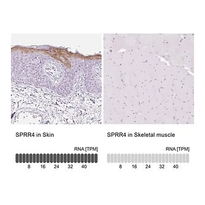 Merck Anti-SPRR4 antibody produced in rabbit
