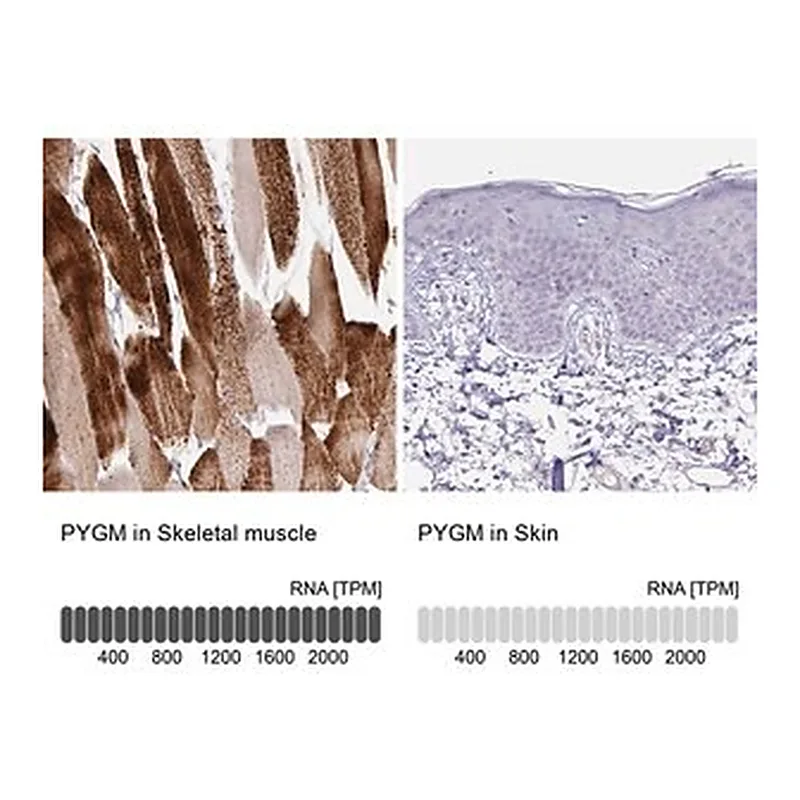 Merck Anti-PYGM antibody produced in rabbit