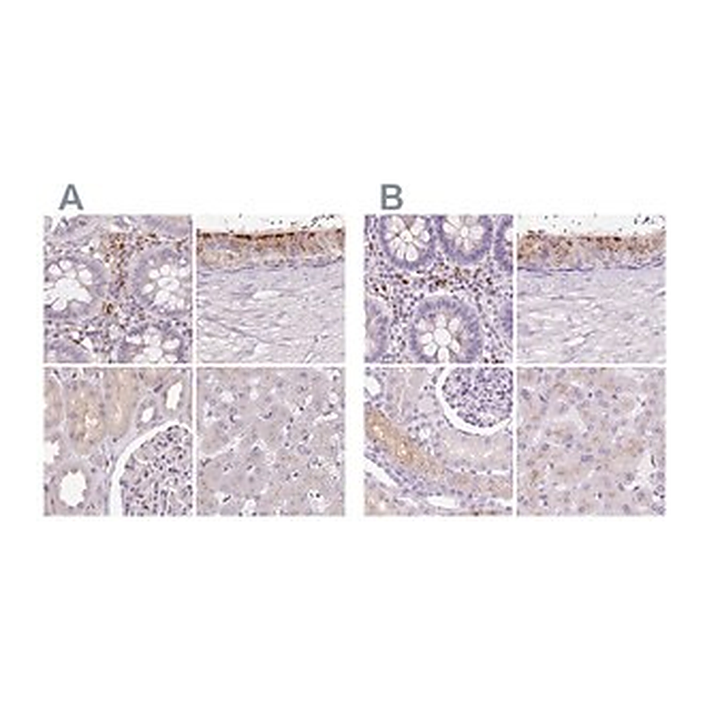 Merck Anti-HEXB antibody produced in rabbit