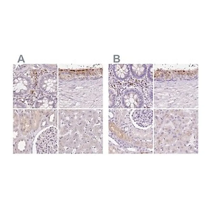 Merck Anti-HEXB antibody produced in rabbit