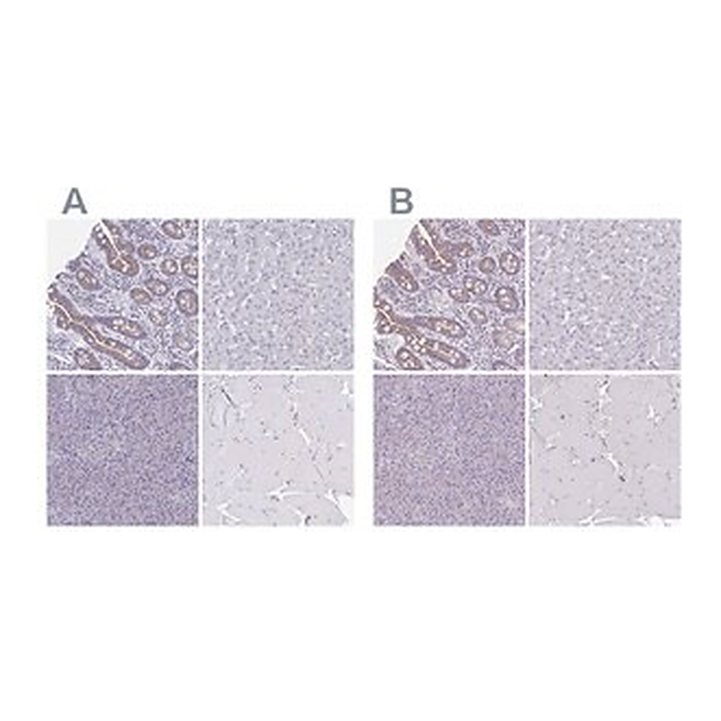 Merck Anti-CHMP5 antibody produced in rabbit