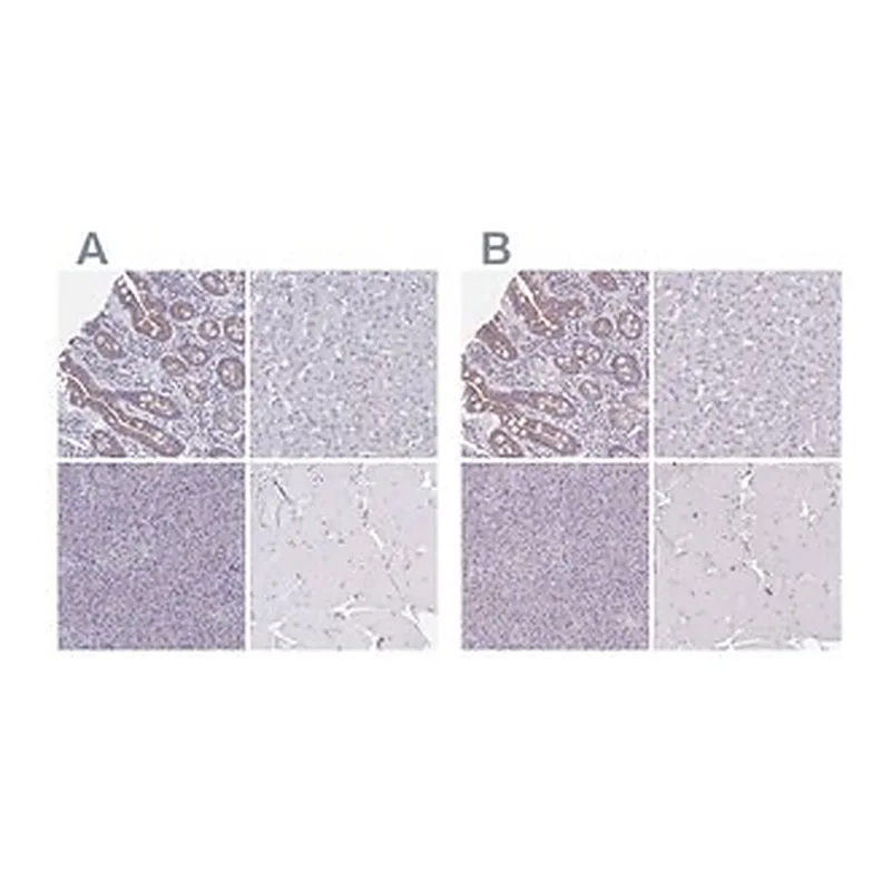 Merck Anti-CHMP5 antibody produced in rabbit