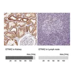 Merck Anti-ETNK2 antibody produced in rabbit