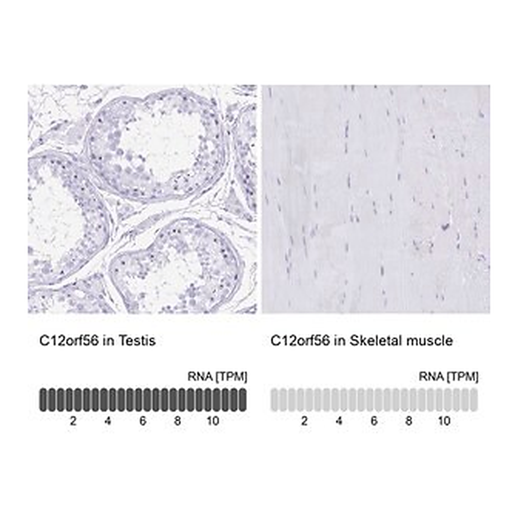 Merck Anti-C12orf56 antibody produced in rabbit