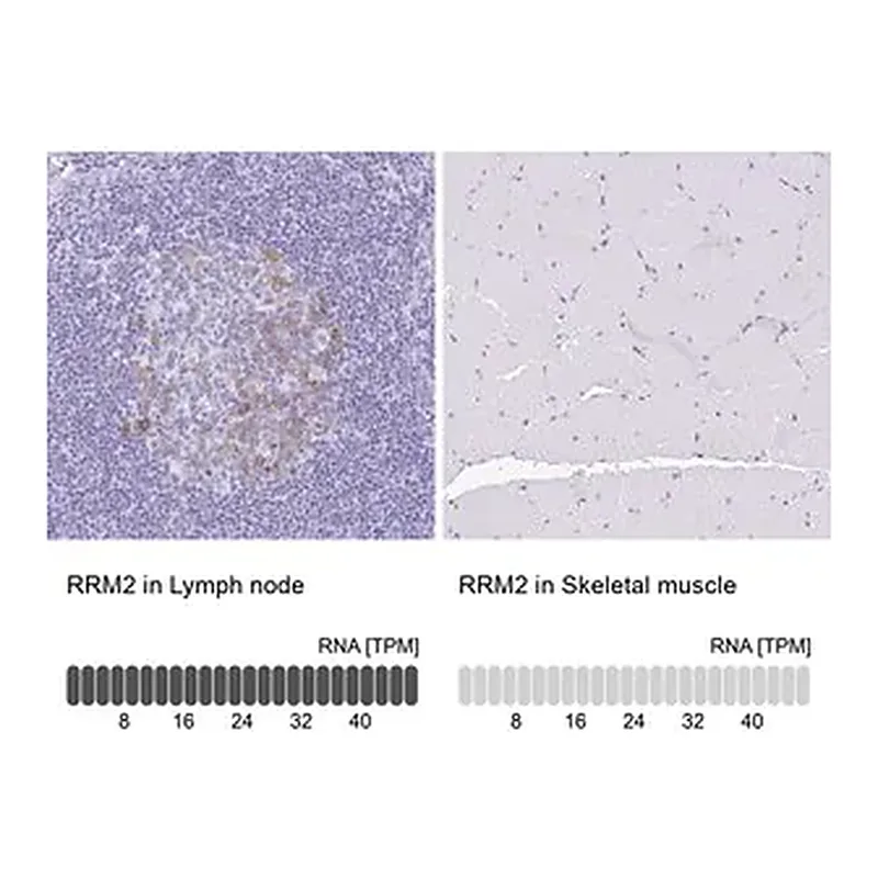 Merck Anti-RRM2 antibody produced in rabbit