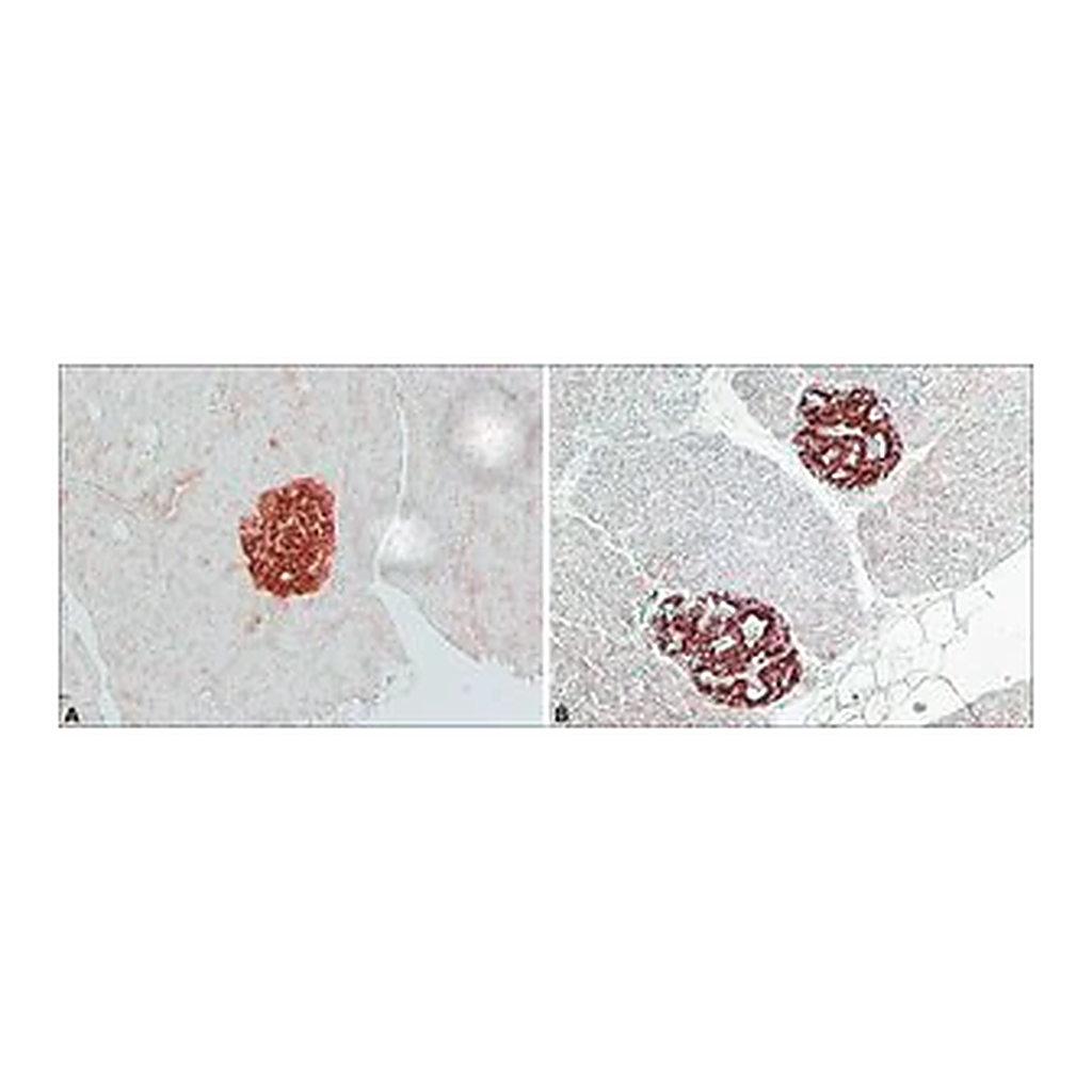 Merck Anti-IAPP (N-terminal) antibody produced in rabbit
