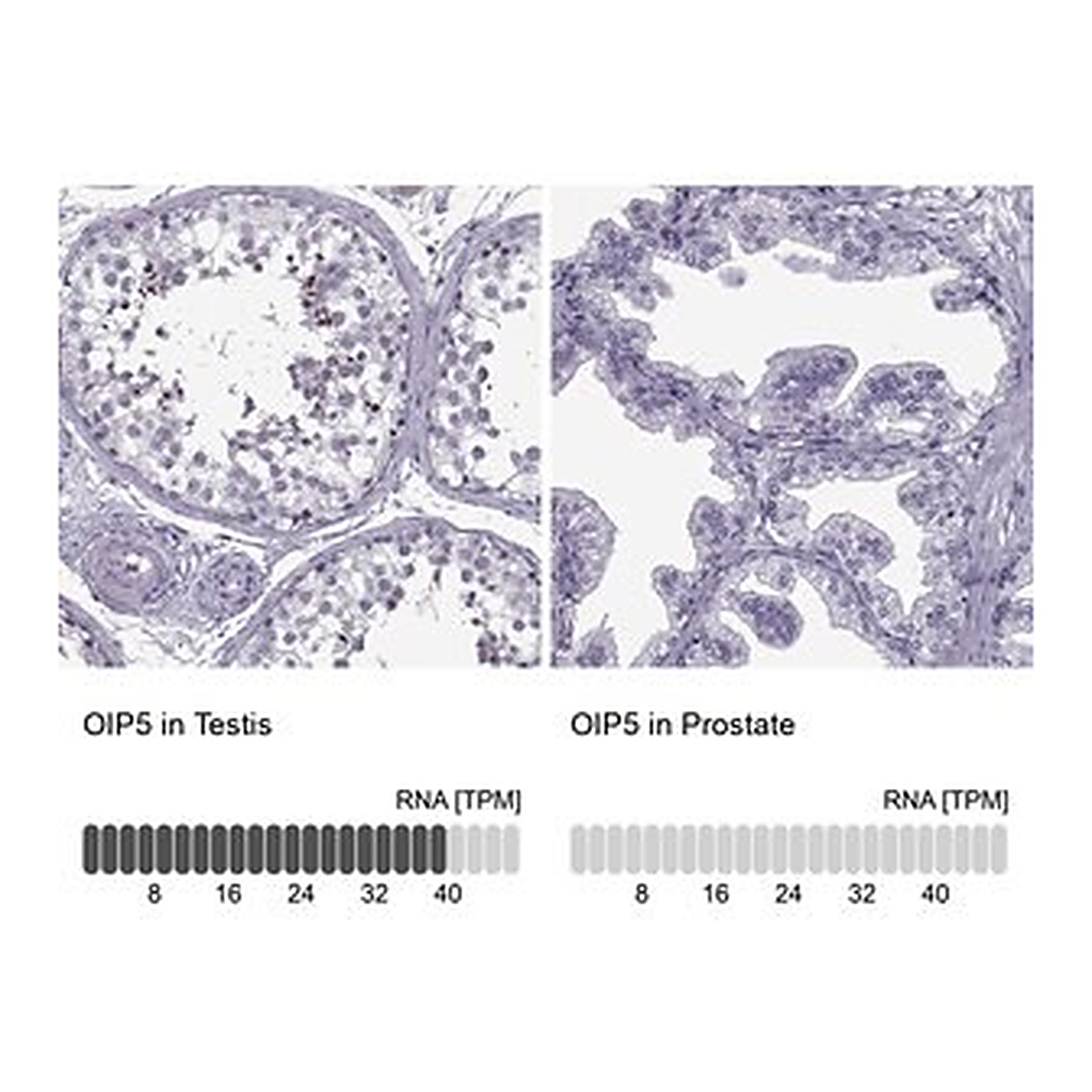 Merck Anti-OIP5 antibody produced in rabbit