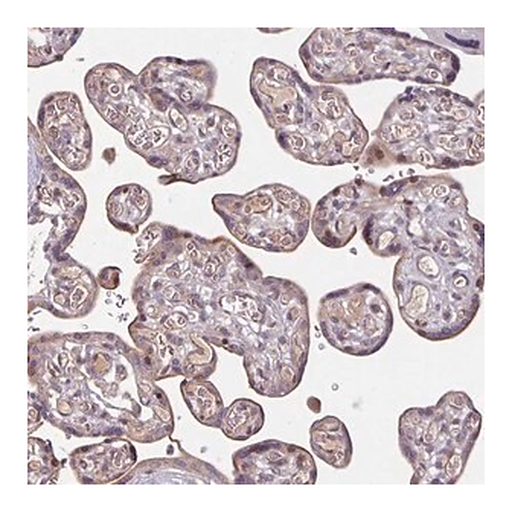 Merck Anti-TMEM88 antibody produced in rabbit | 캐시바이