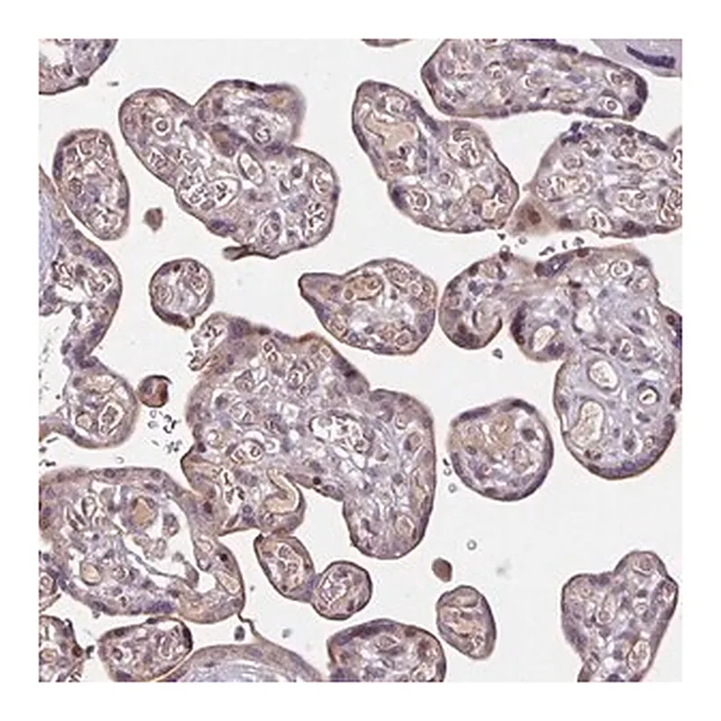 Merck Anti-TMEM88 antibody produced in rabbit | 캐시바이