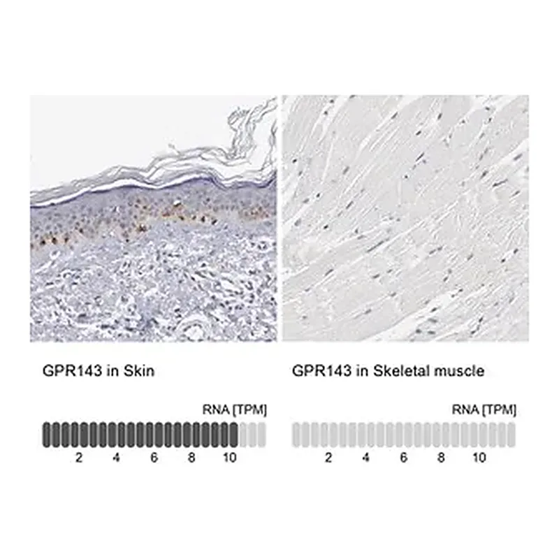 Merck Anti-GPR143 antibody produced in rabbit