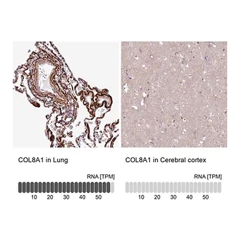 Merck Anti-COL8A1 antibody produced in rabbit