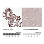 Merck Anti-COL8A1 antibody produced in rabbit